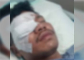 Azmar, pemuda yang dibacok Beramai-ramai hingga Buta
