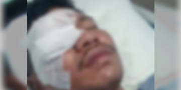 Azmar, pemuda yang dibacok Beramai-ramai hingga Buta