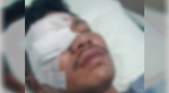 Azmar, pemuda yang dibacok Beramai-ramai hingga Buta