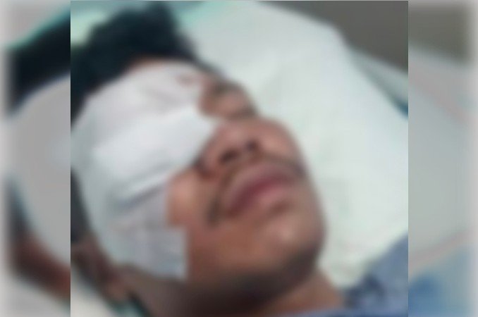 Azmar, pemuda yang dibacok Beramai-ramai hingga Buta